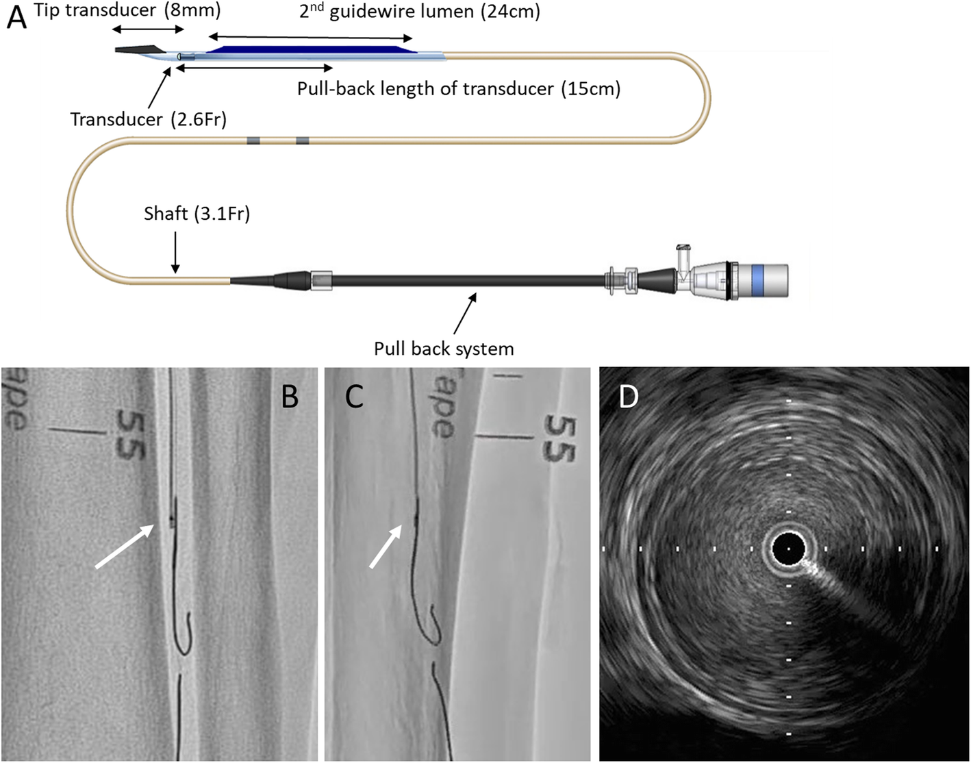 Fig. 1