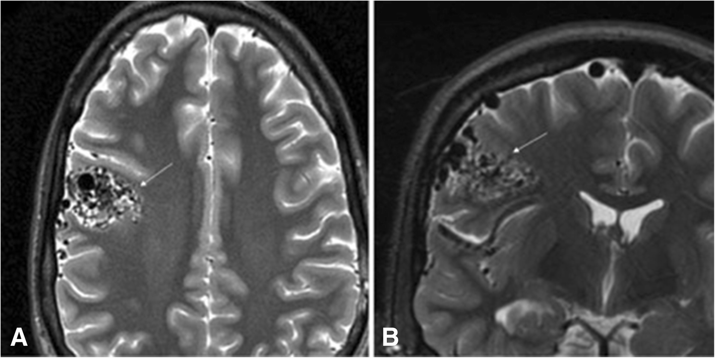 Fig. 10