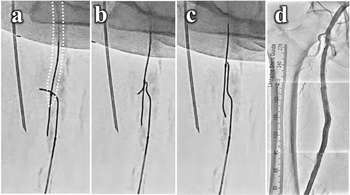 Fig. 3