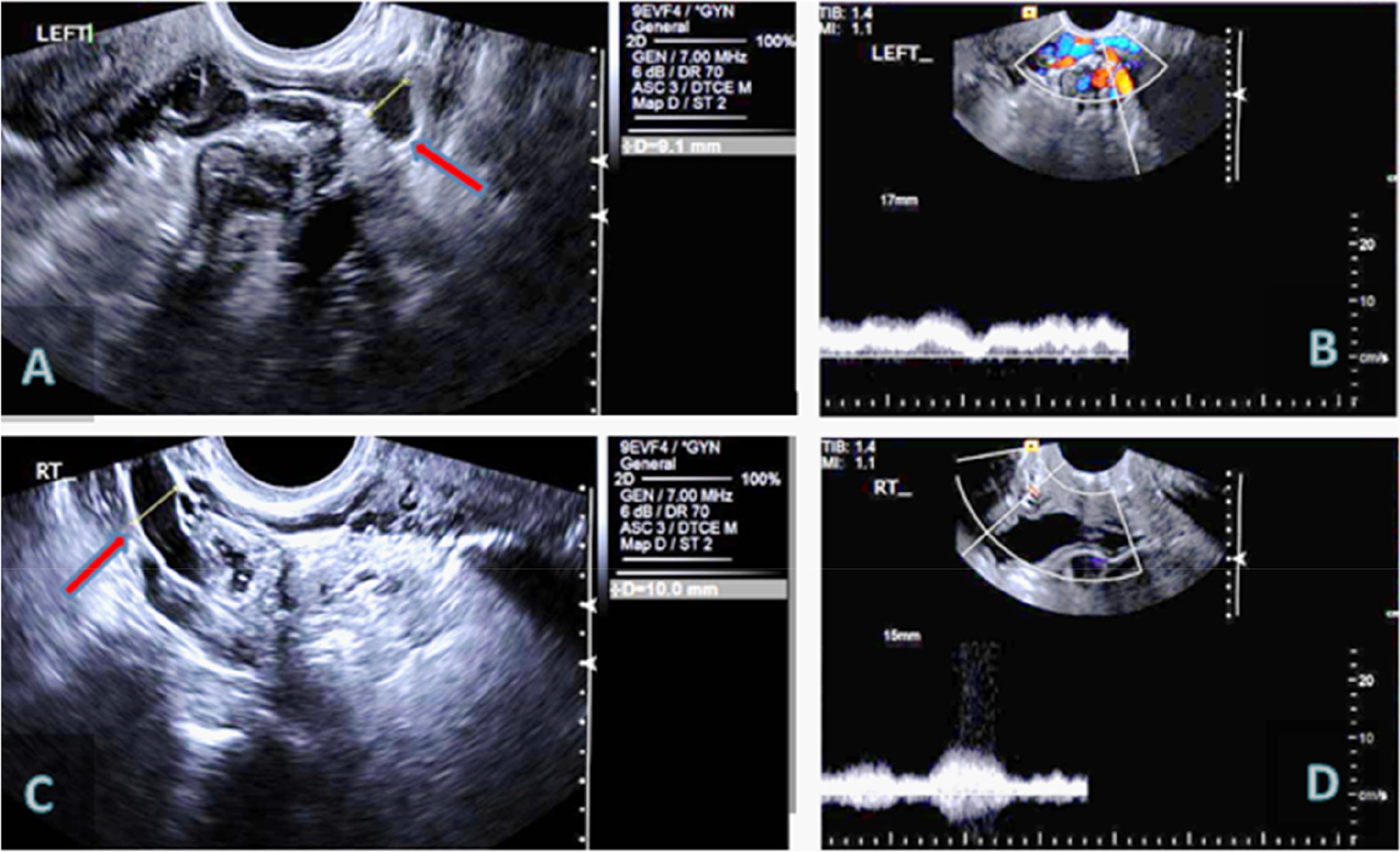 Fig. 3