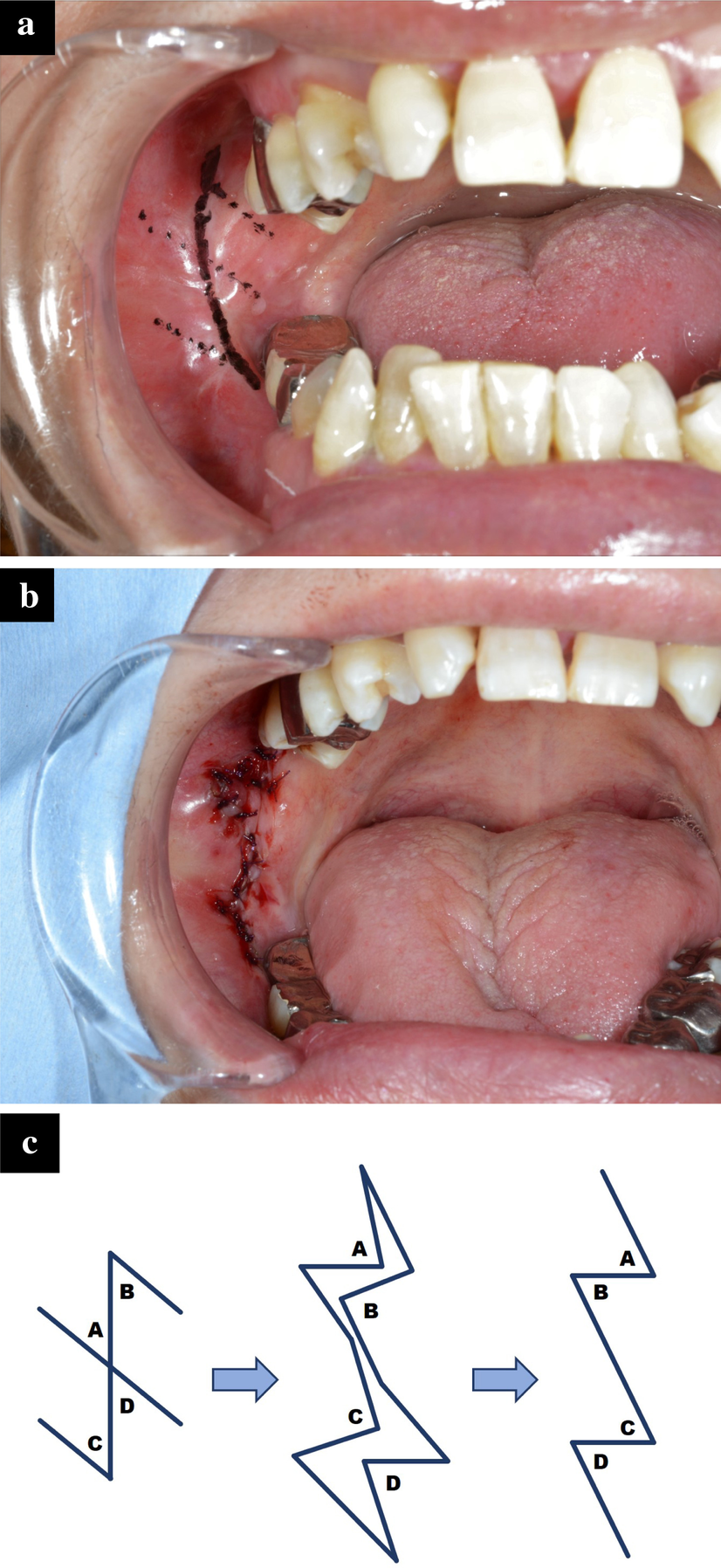 Fig. 7