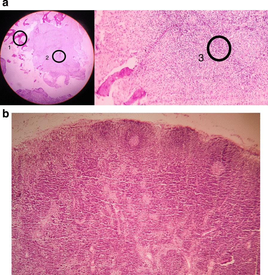 Fig.6