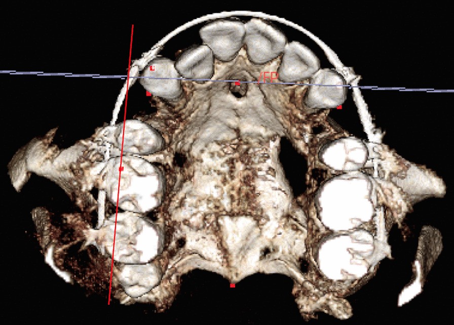 Fig. 2