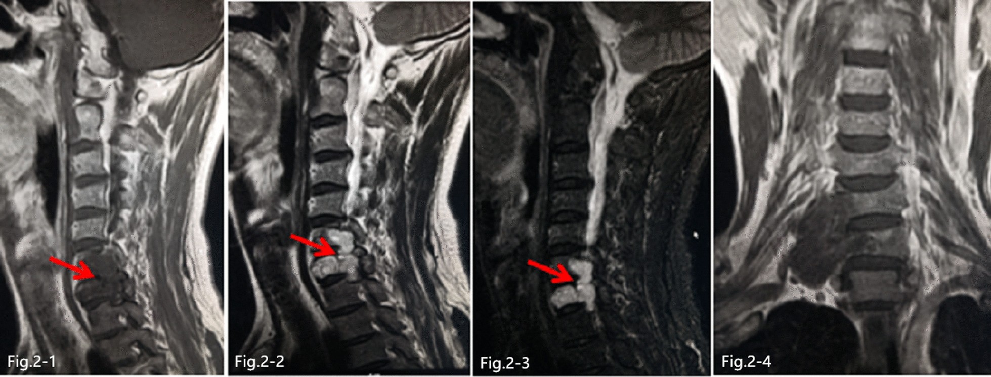 Fig. 2