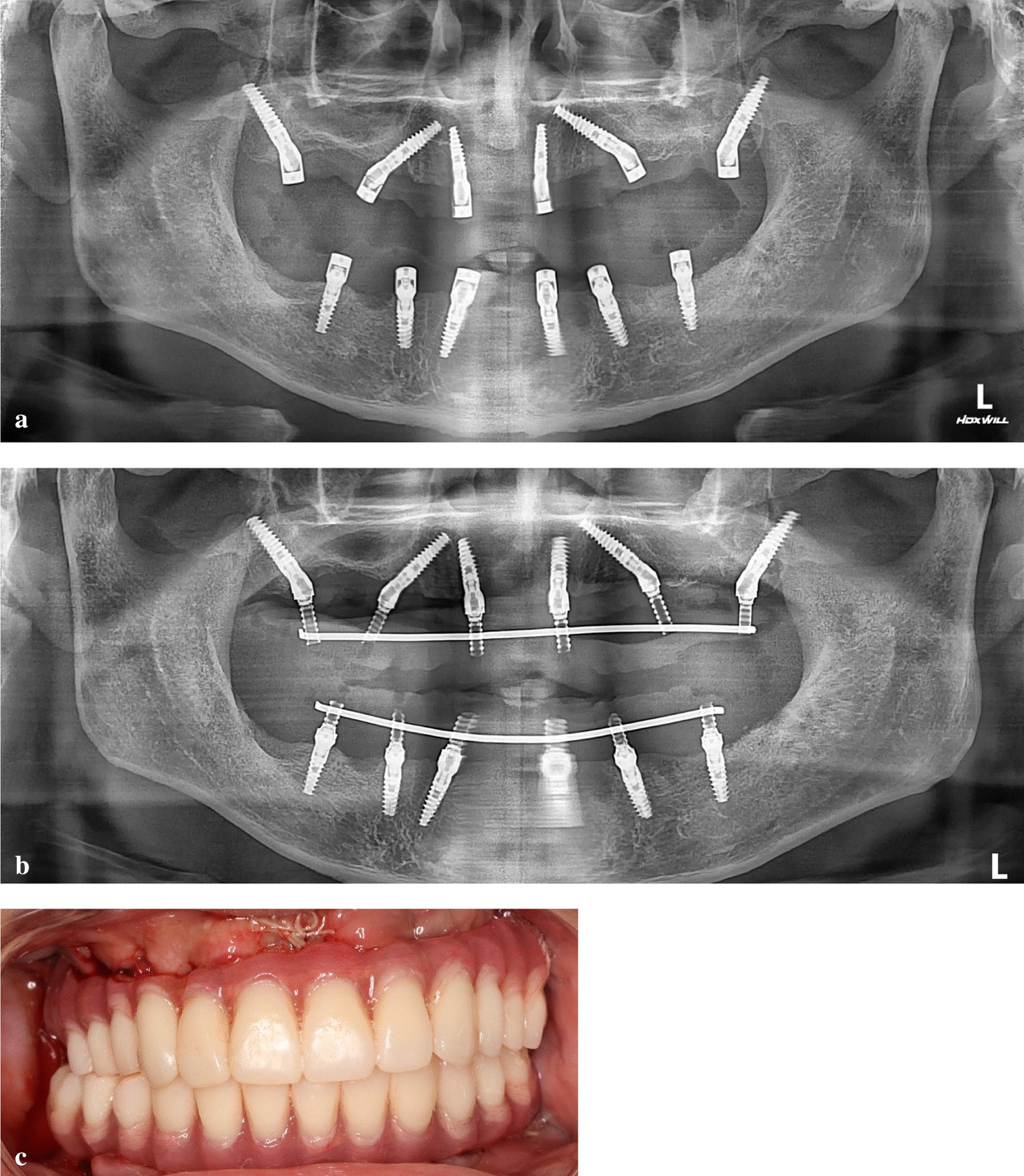 Fig. 3