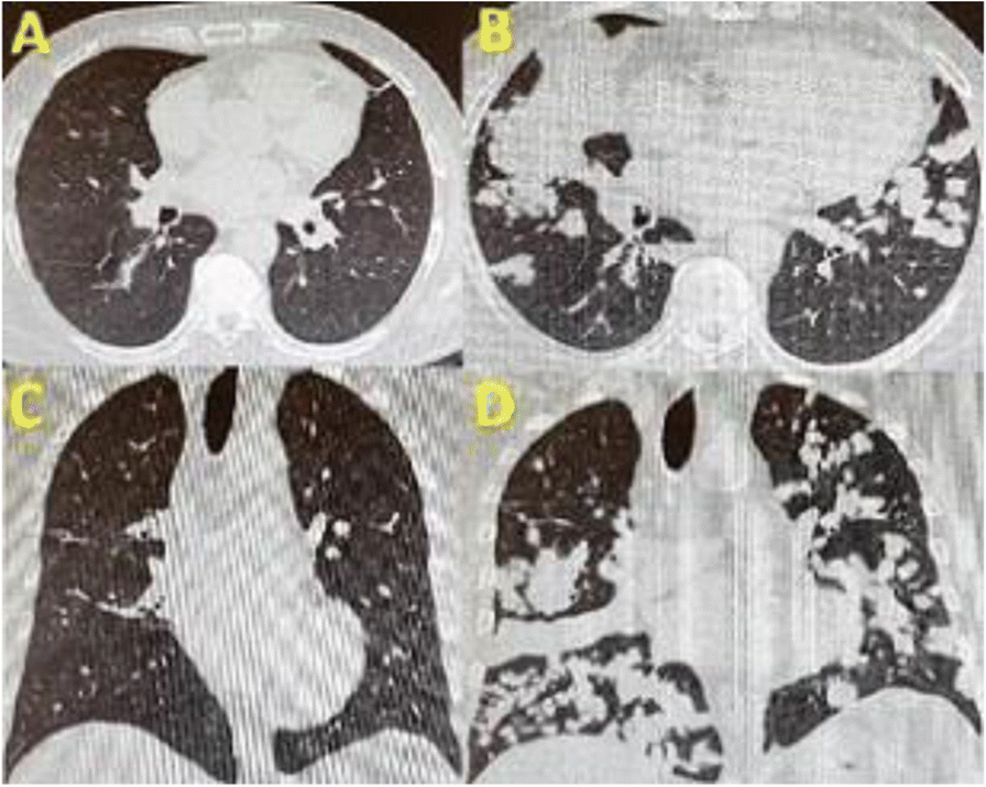 Fig. 1 (abstract P137).