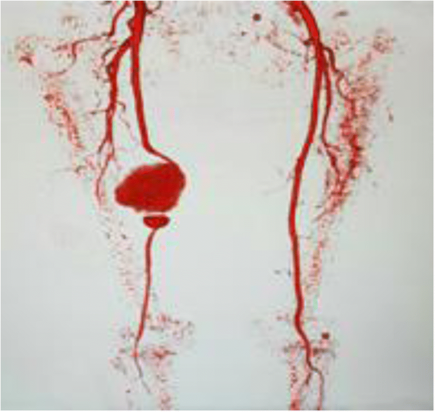 Fig. 1 (abstract P191).