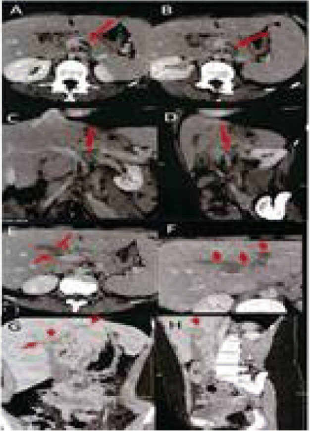 Fig. 1 (abstract P195).