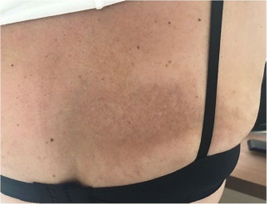 Fig. 1 (abstract P407).