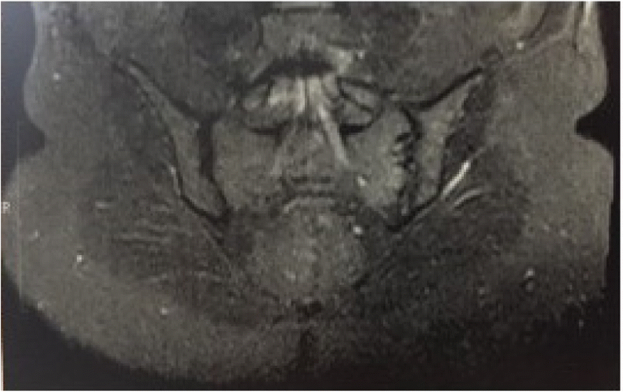 Fig. 2 (abstract P443).