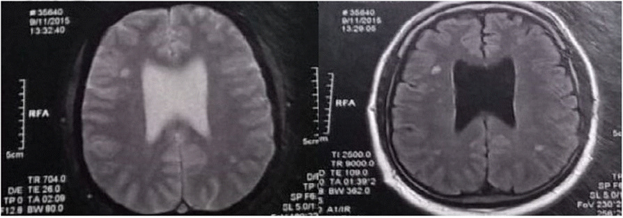 Fig. 1 (abstract P035).