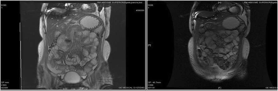 Fig. 1 (abstract P111).