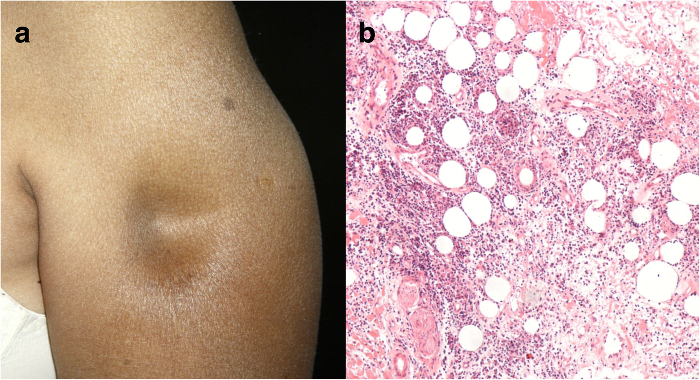 Fig. 6