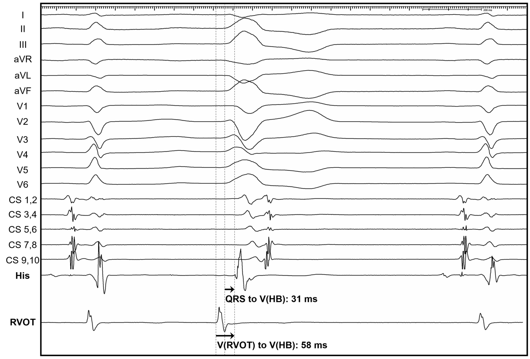 Fig. 2