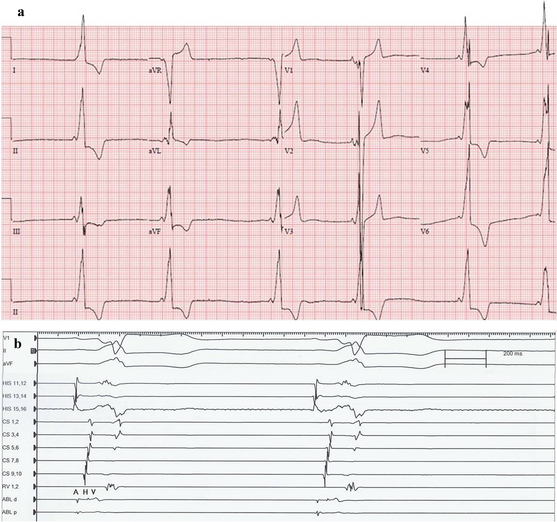 Fig. 2