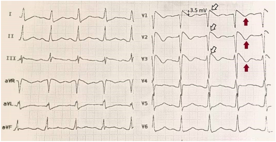 Fig. 1