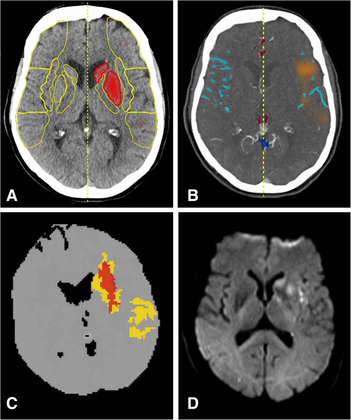 Fig. 4