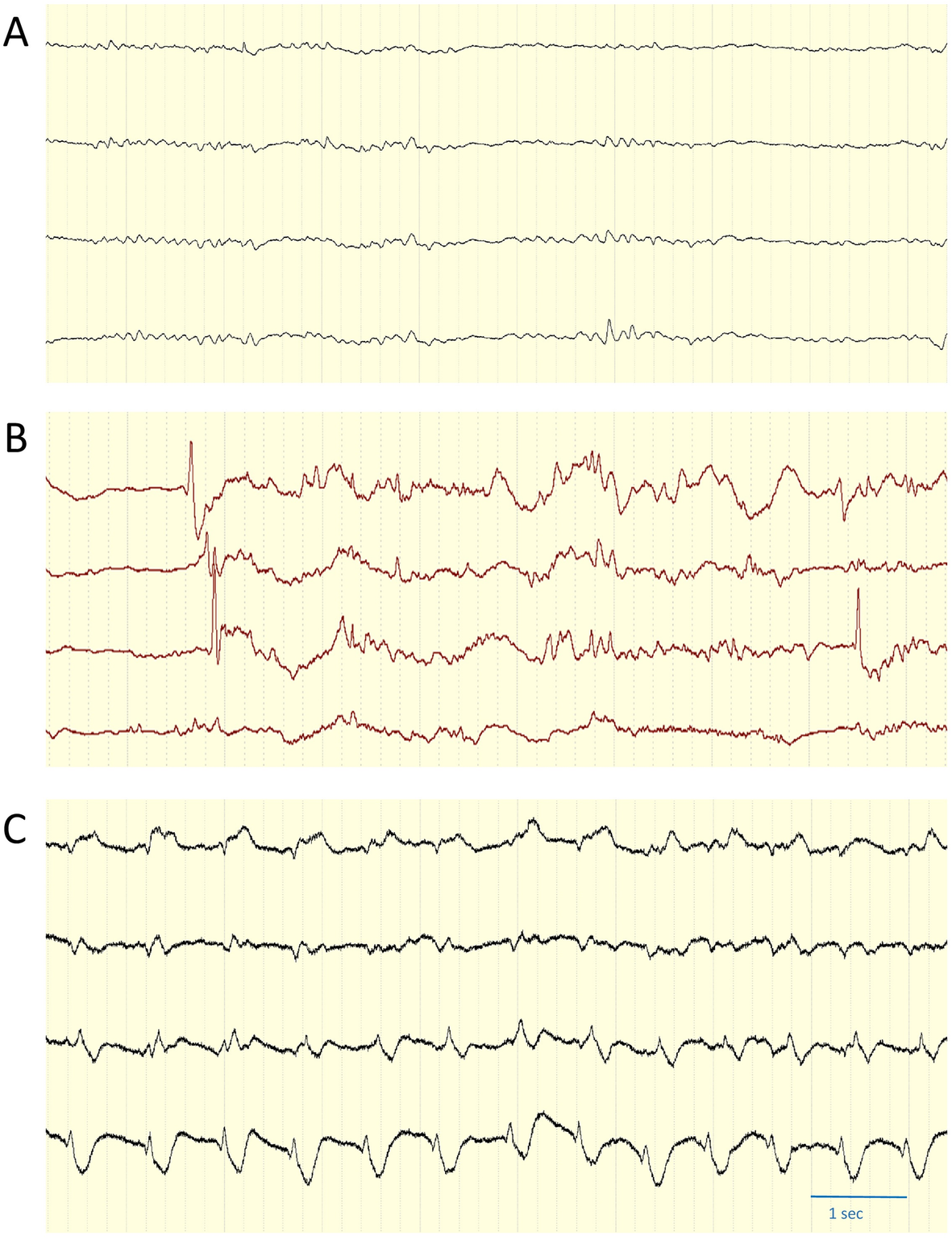 Fig. 4