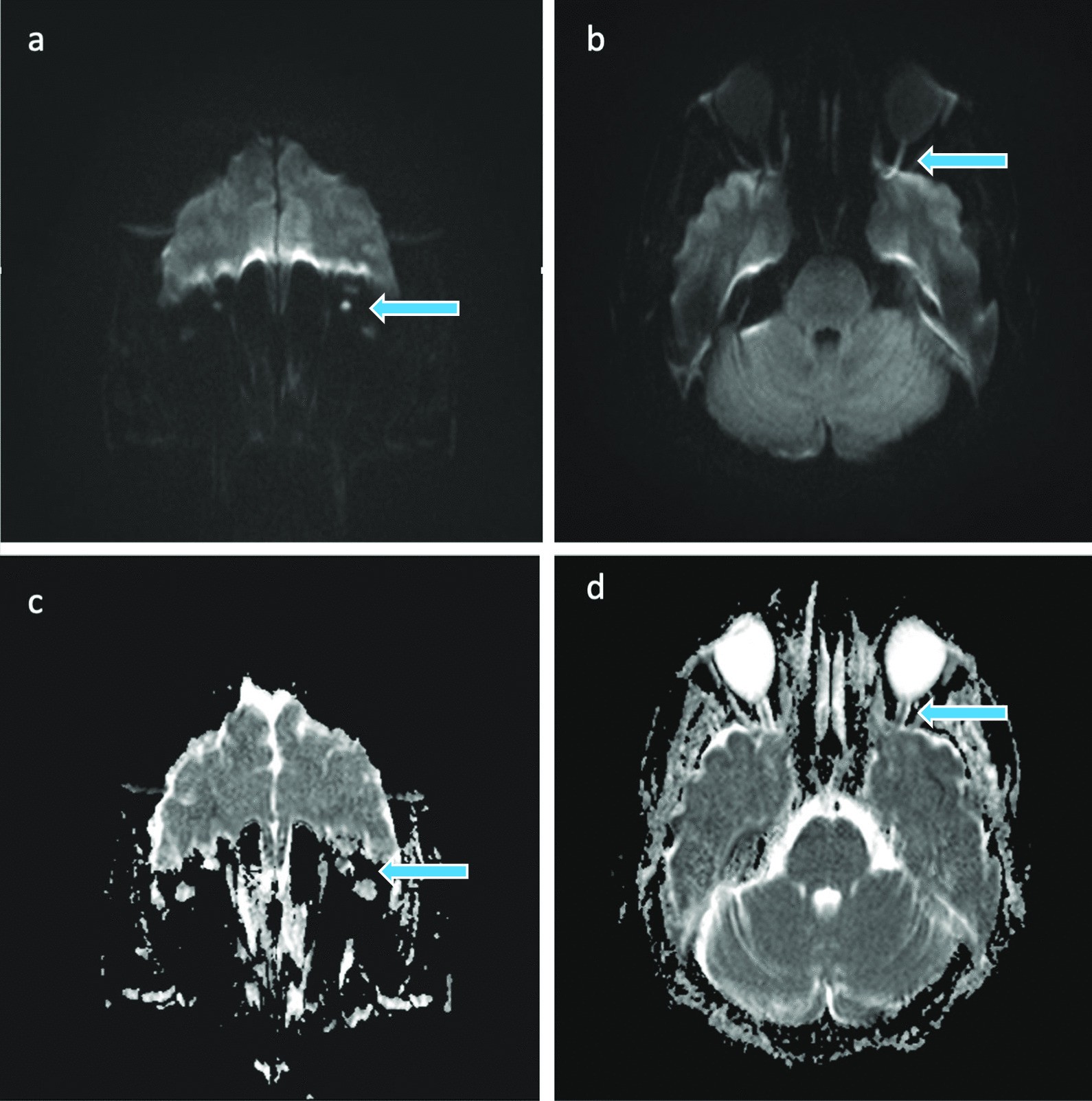 Fig. 1