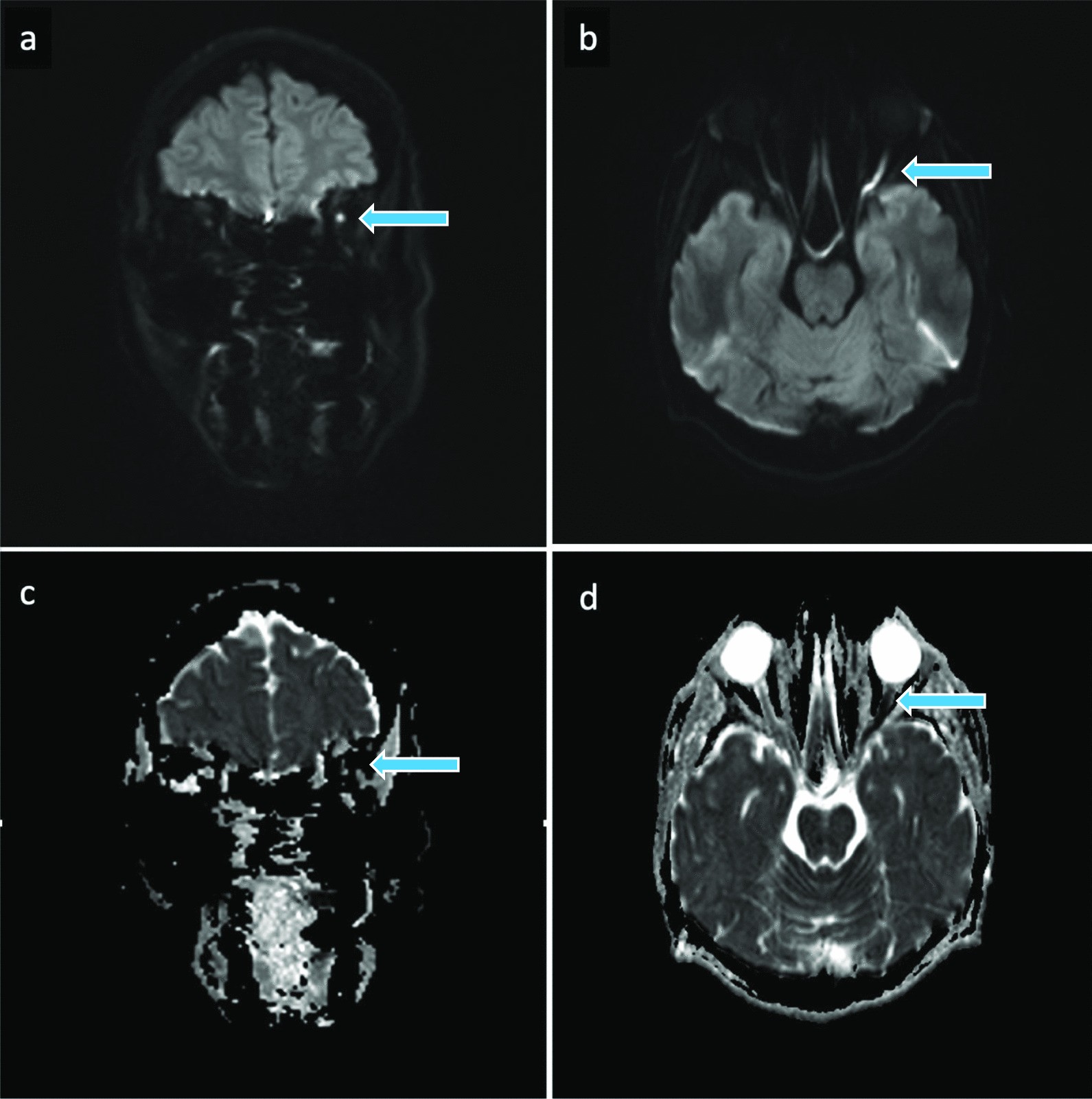 Fig. 4