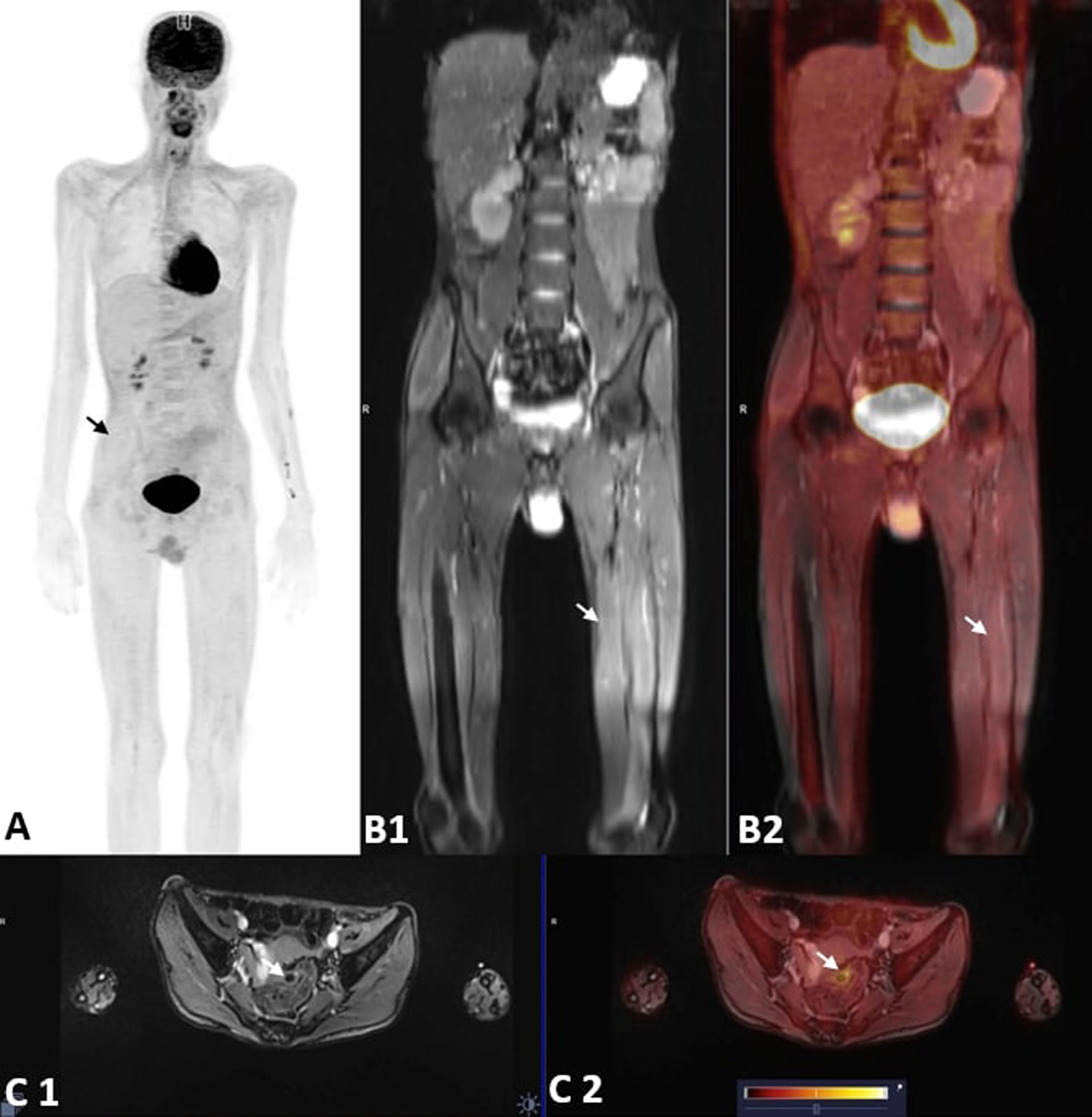 Fig. 2