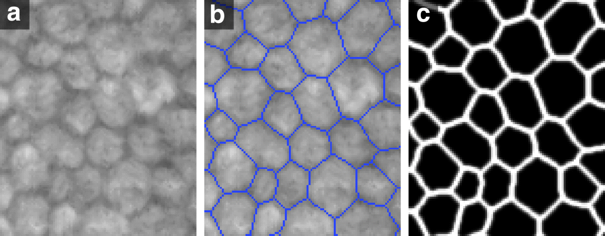 Fig. 10