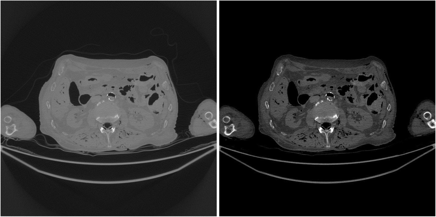 Fig. 7