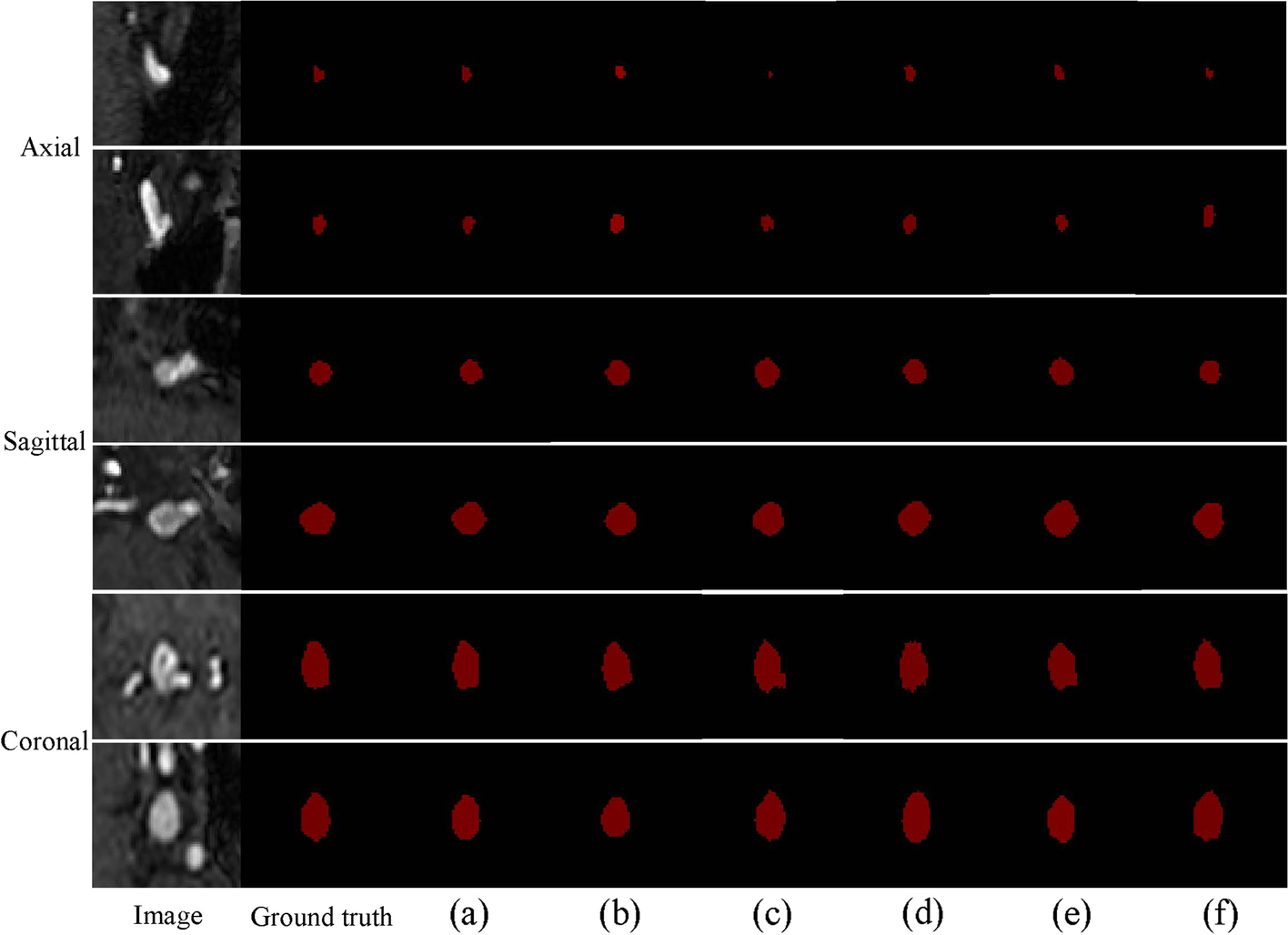 Fig. 10