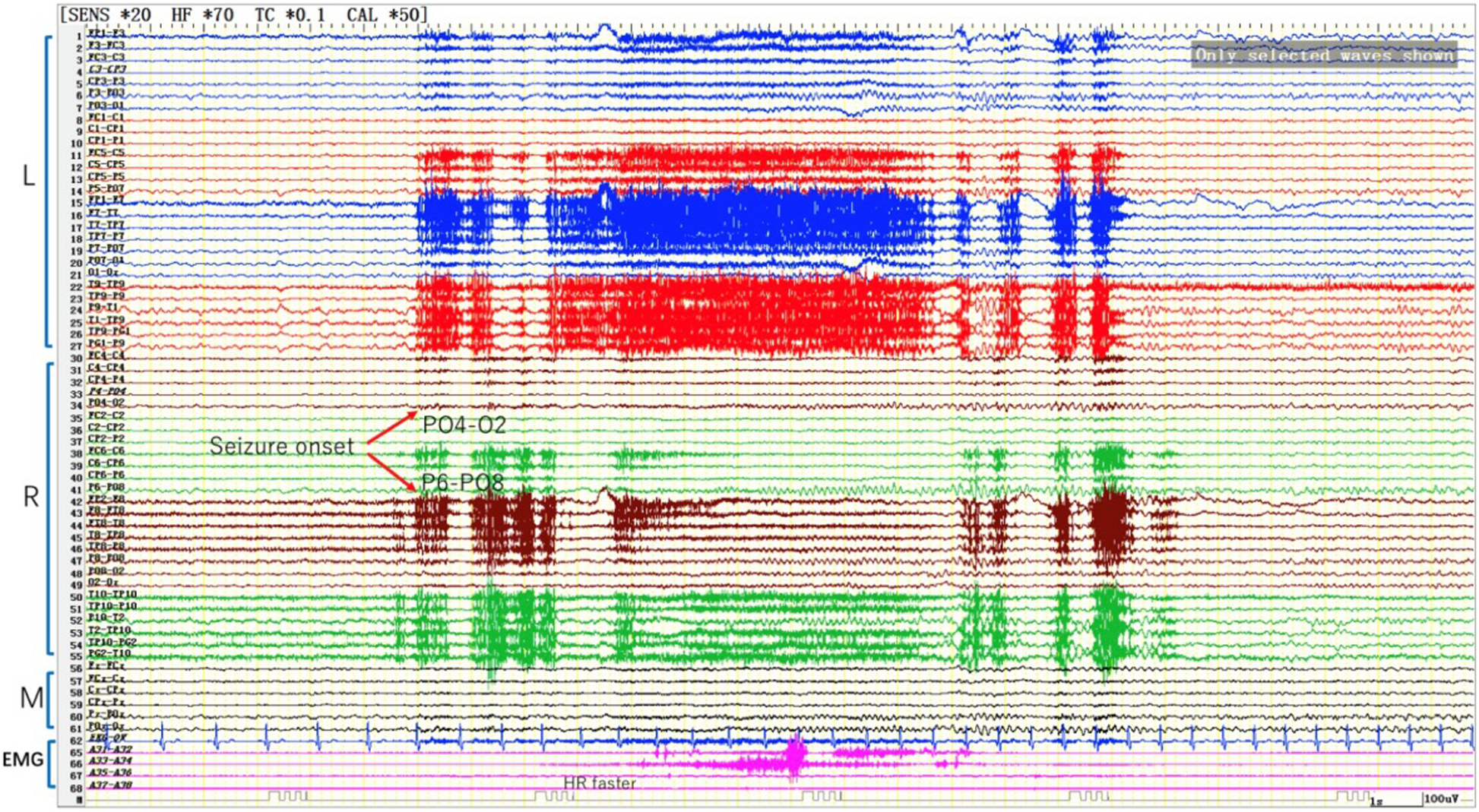 Fig. 4