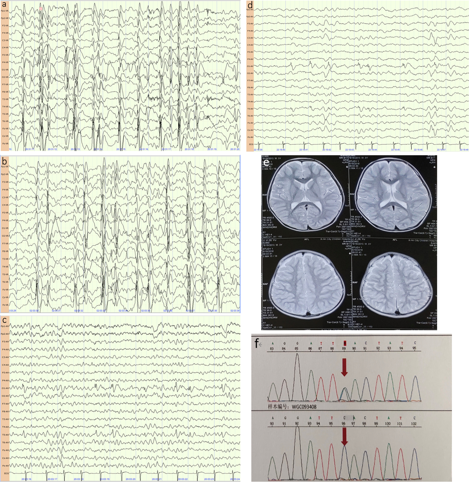 Fig. 3