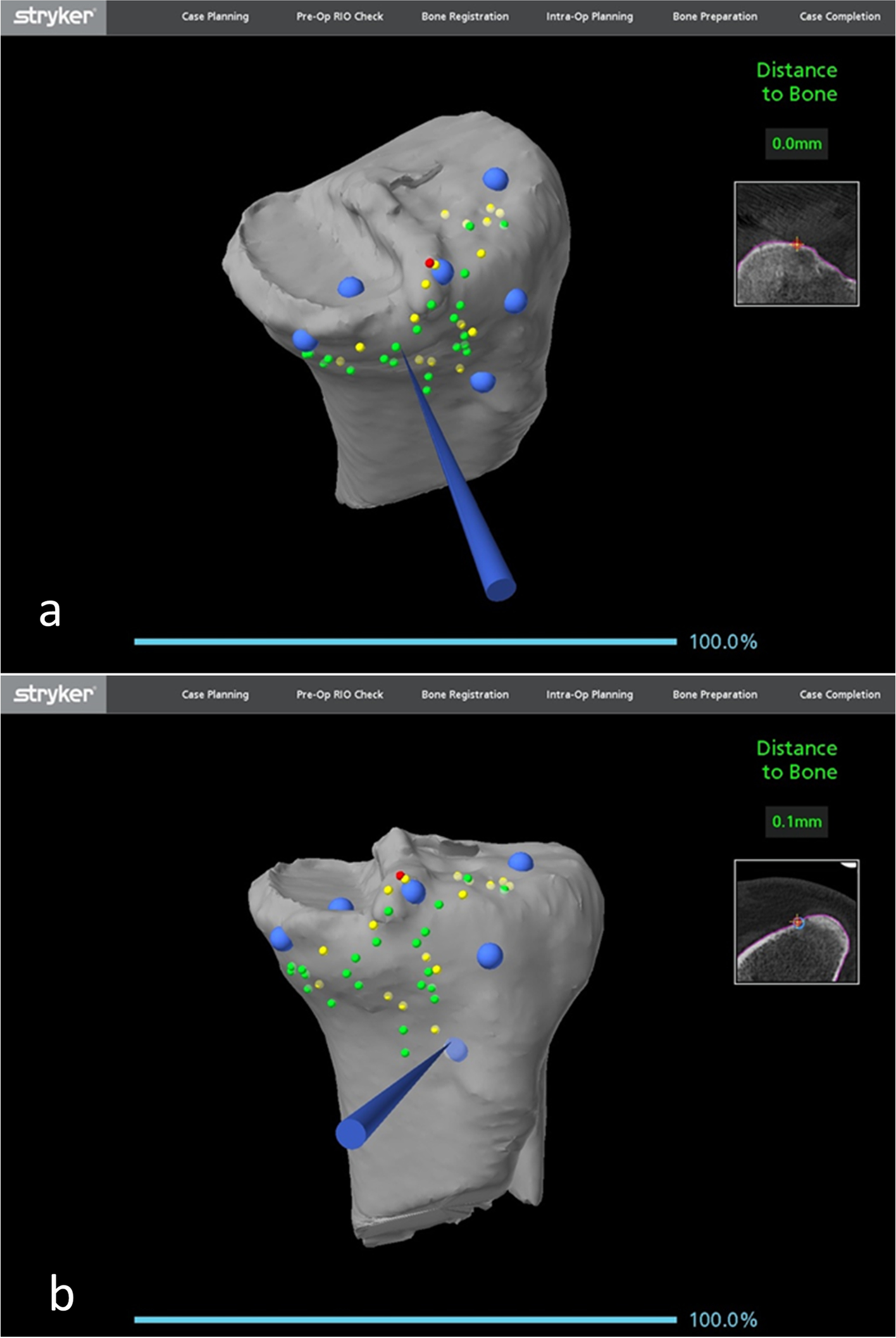 Fig. 14