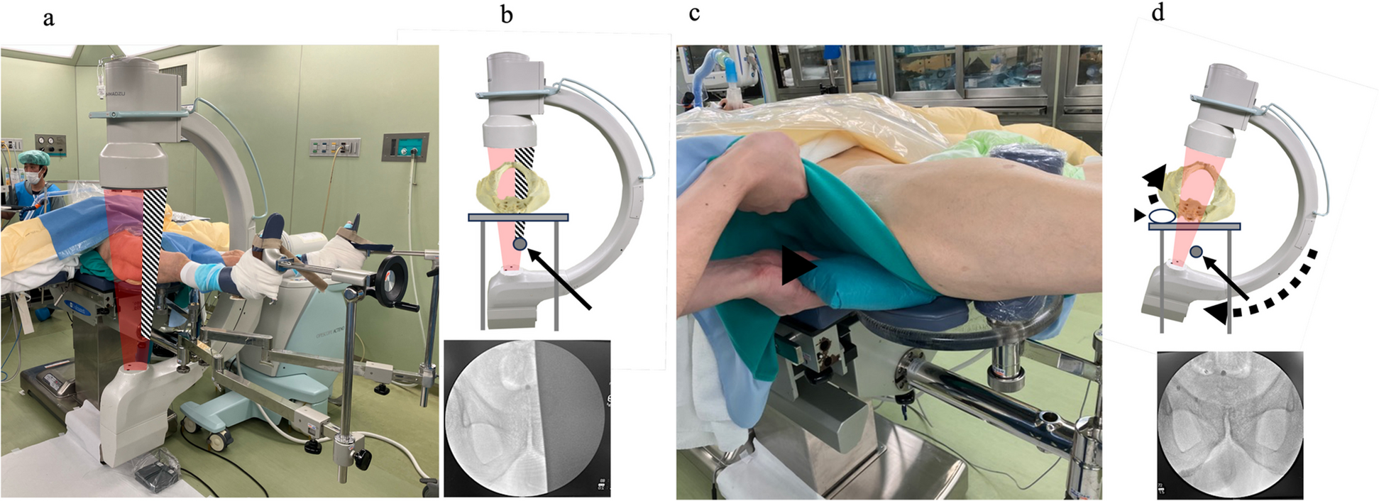 Fig. 1