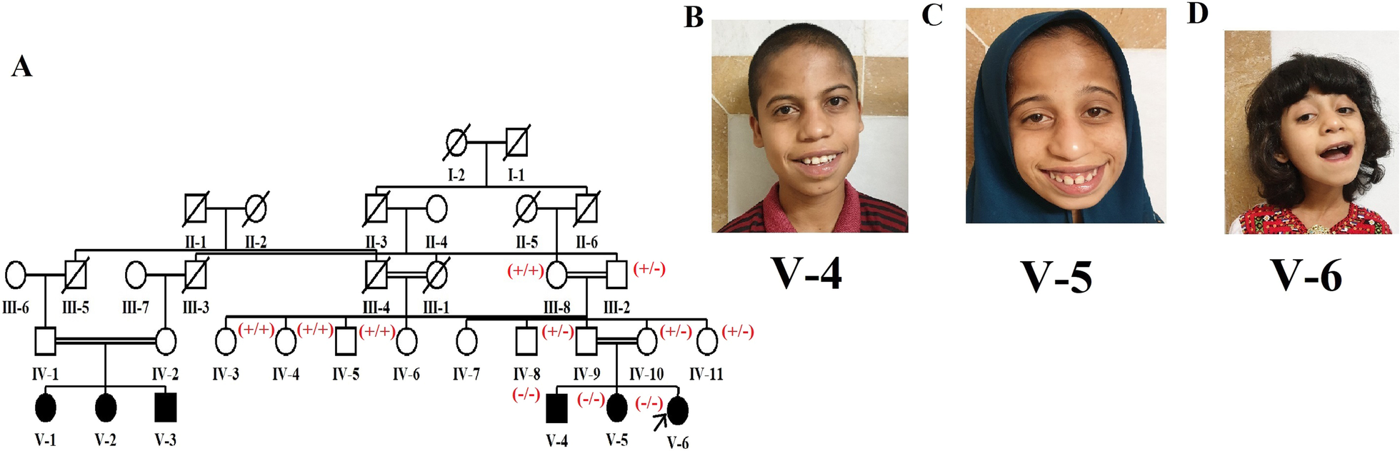 Fig. 1