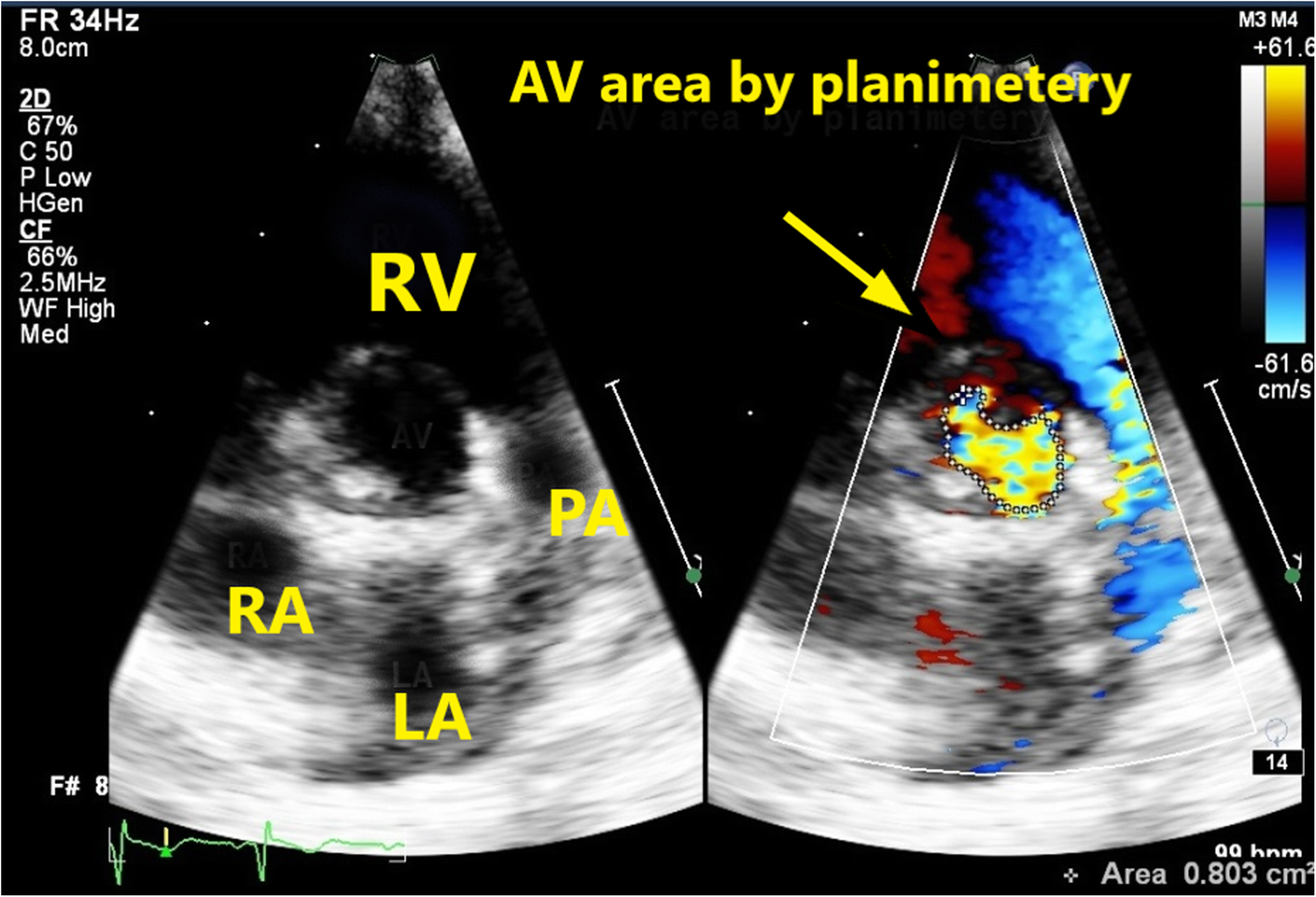 Fig. 3