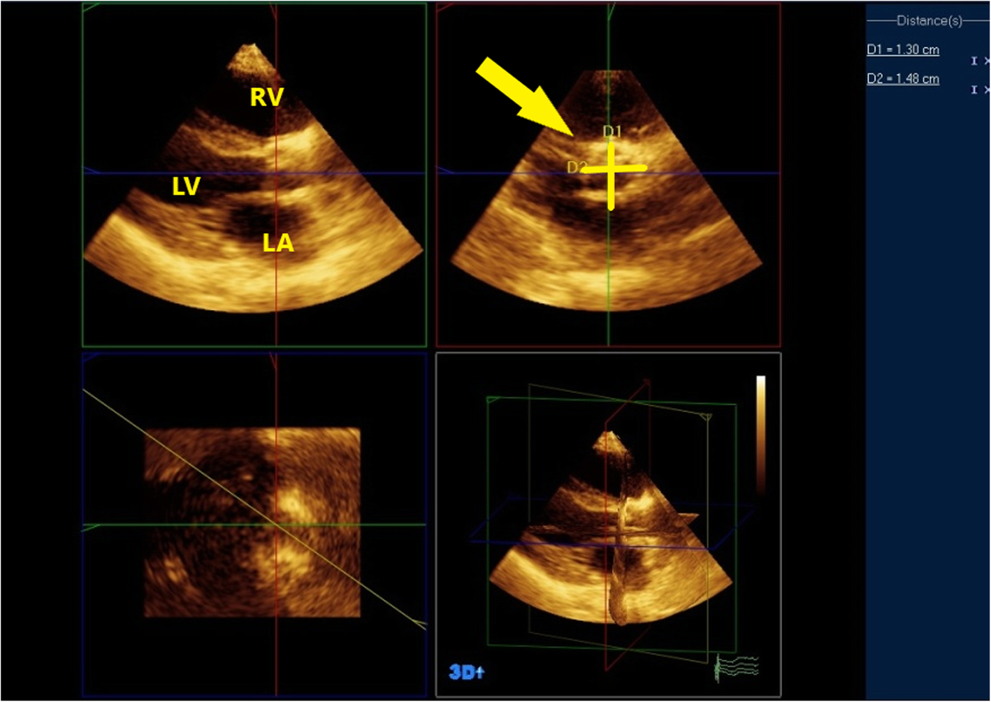 Fig. 4