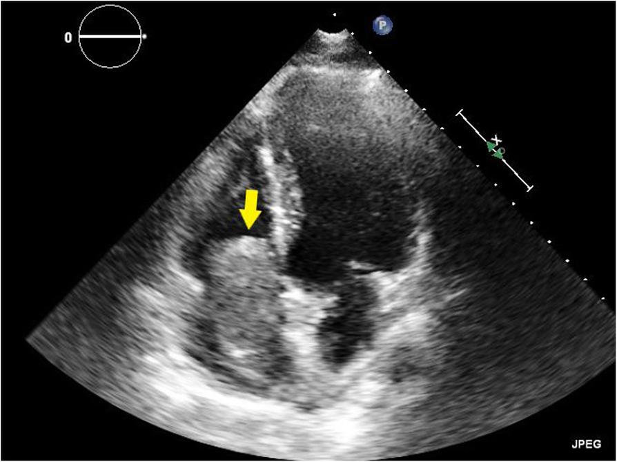 Fig. 2