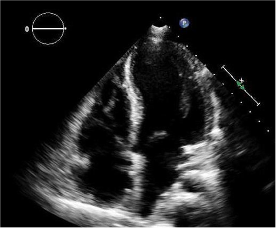 Fig. 6