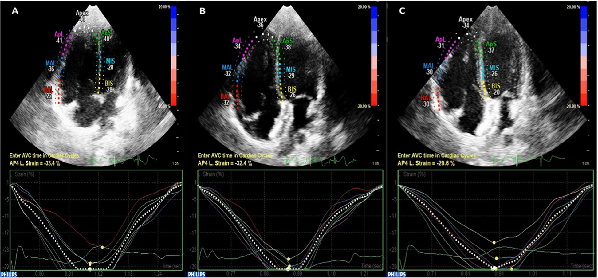 Fig. 2