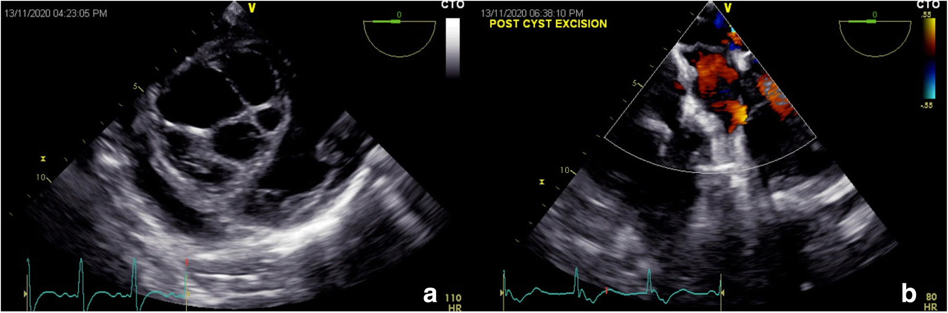 Fig. 4