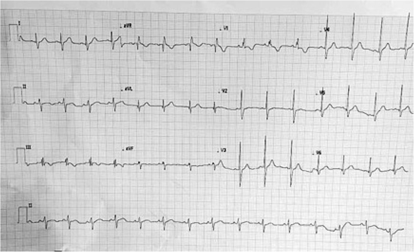 Fig. 1