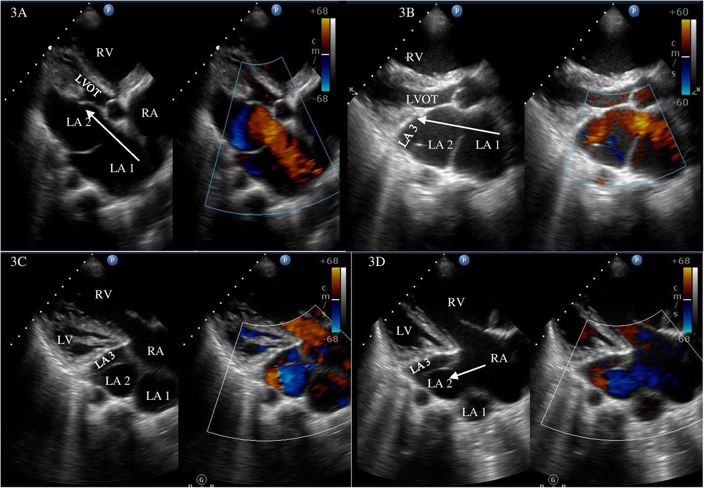 Fig. 3