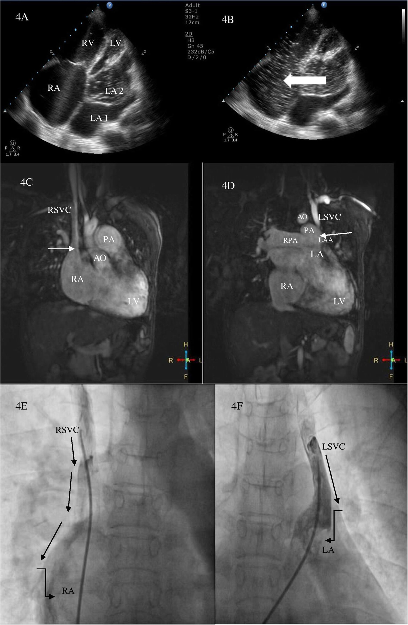 Fig. 4