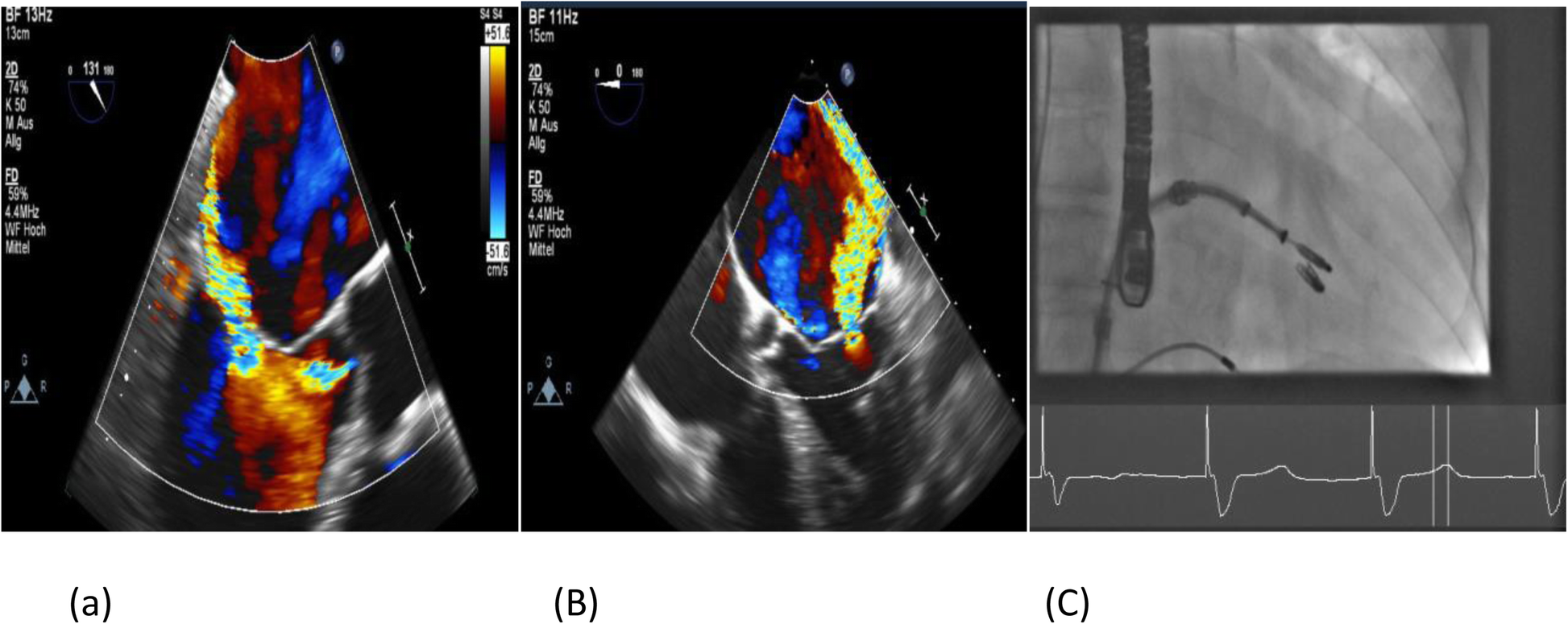 Fig. 4