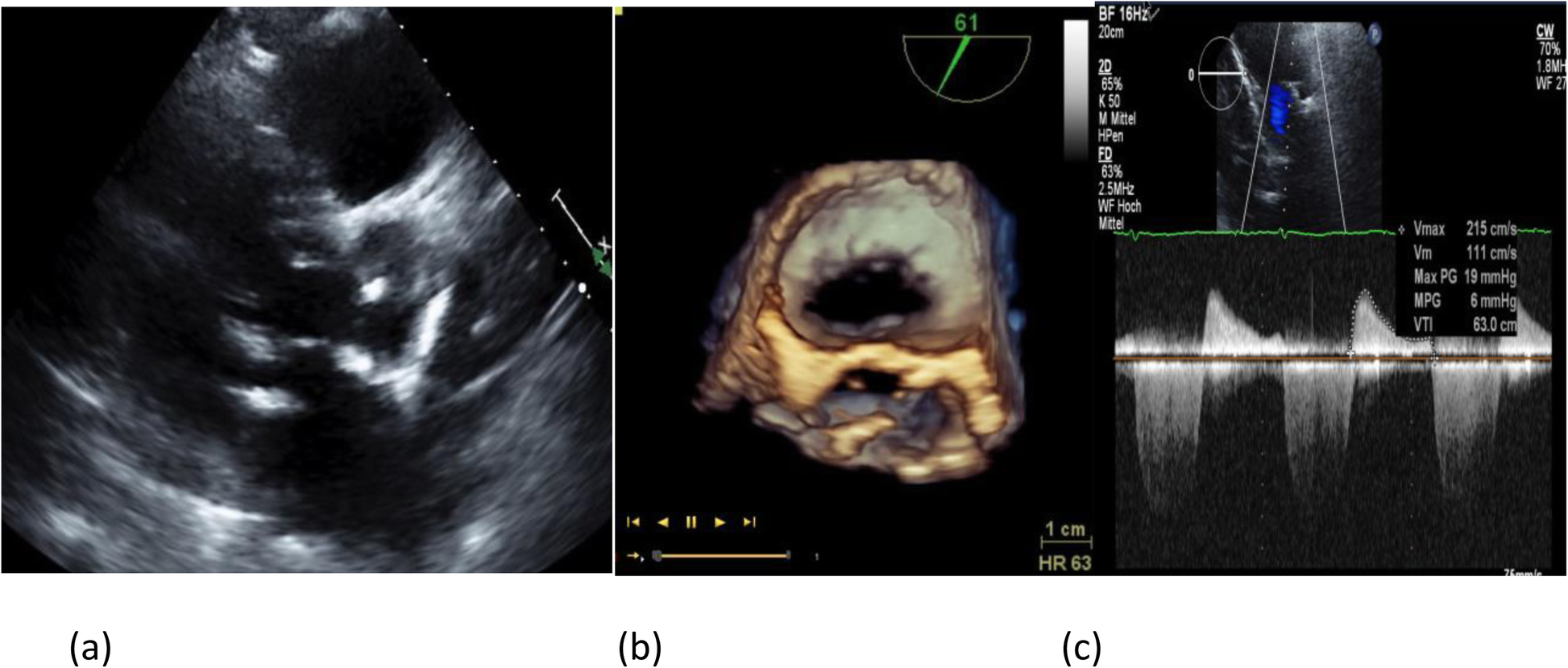 Fig. 5