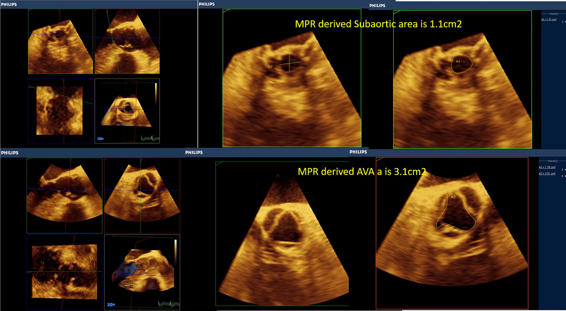 Fig. 12