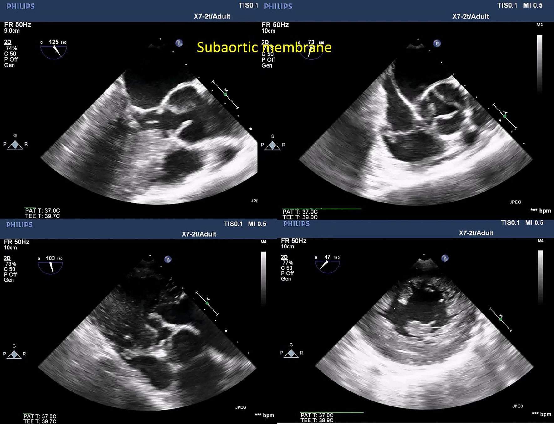 Fig. 13