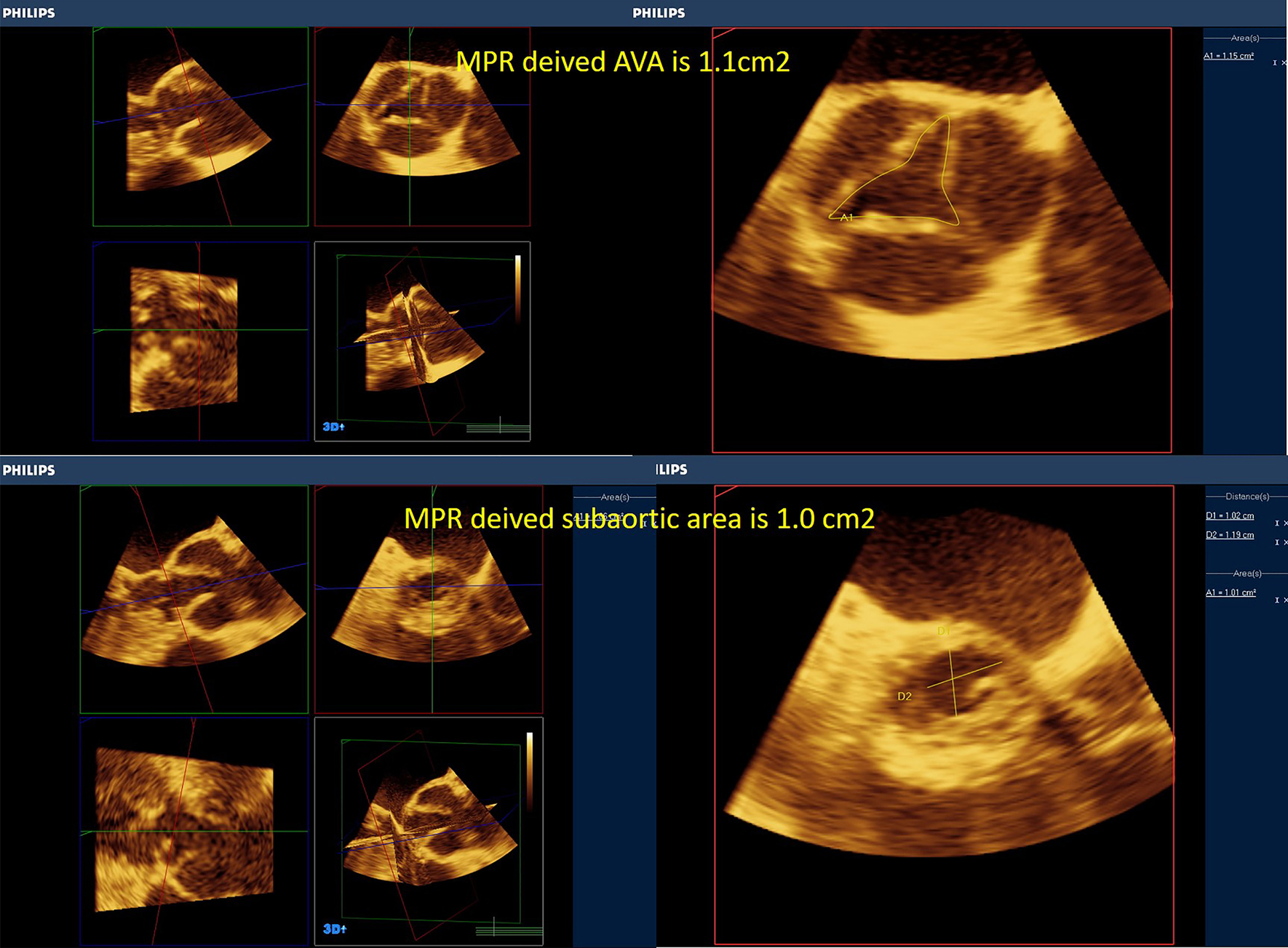 Fig. 14