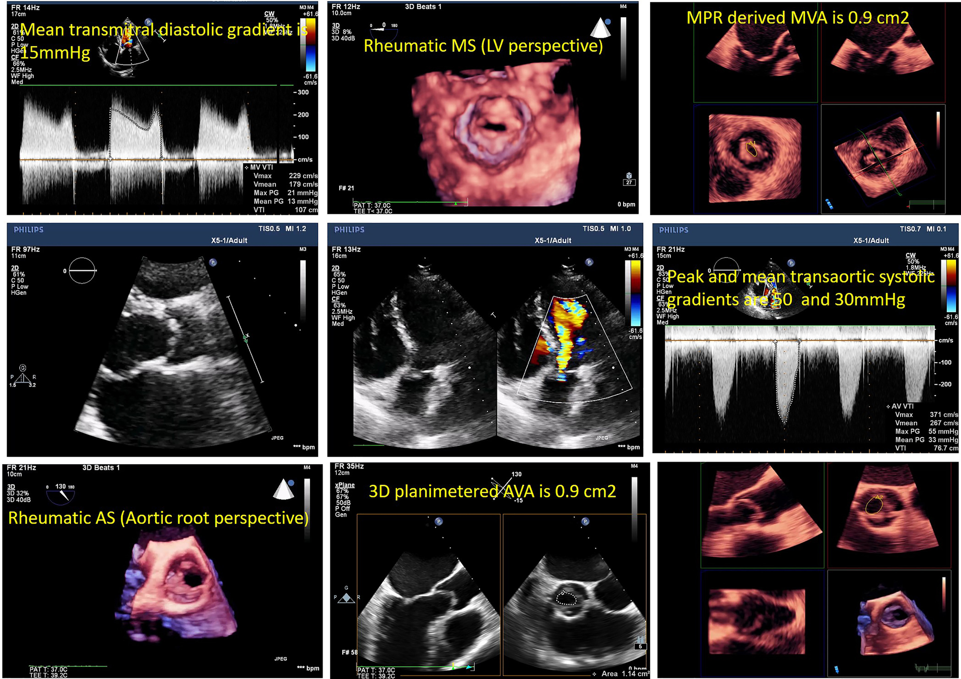 Fig. 9