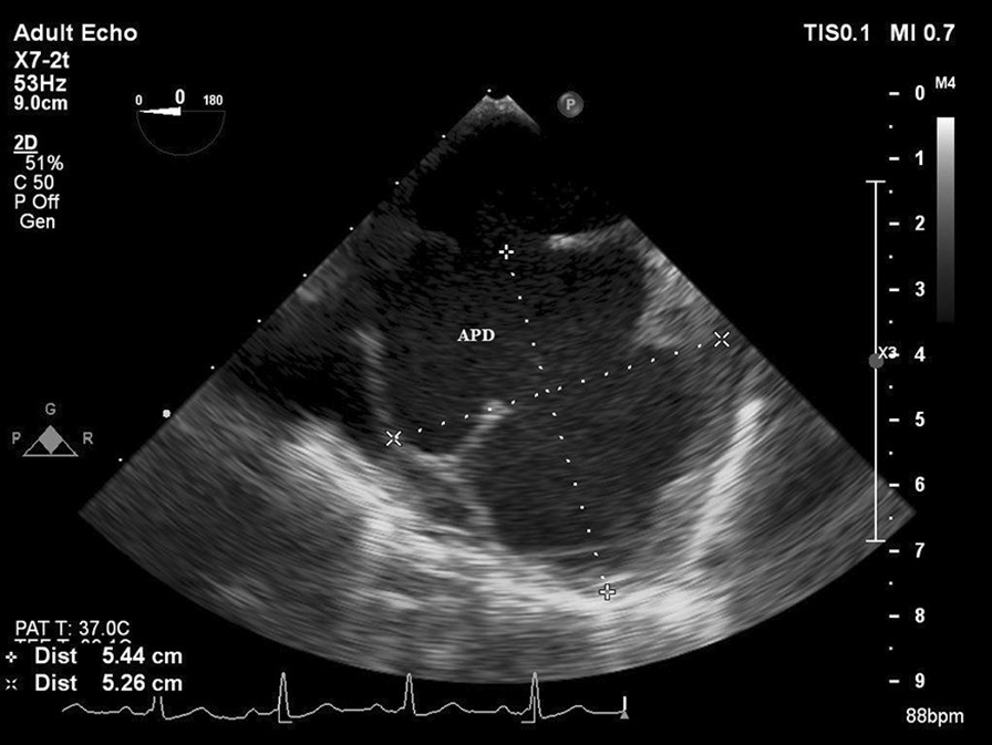 Fig. 2