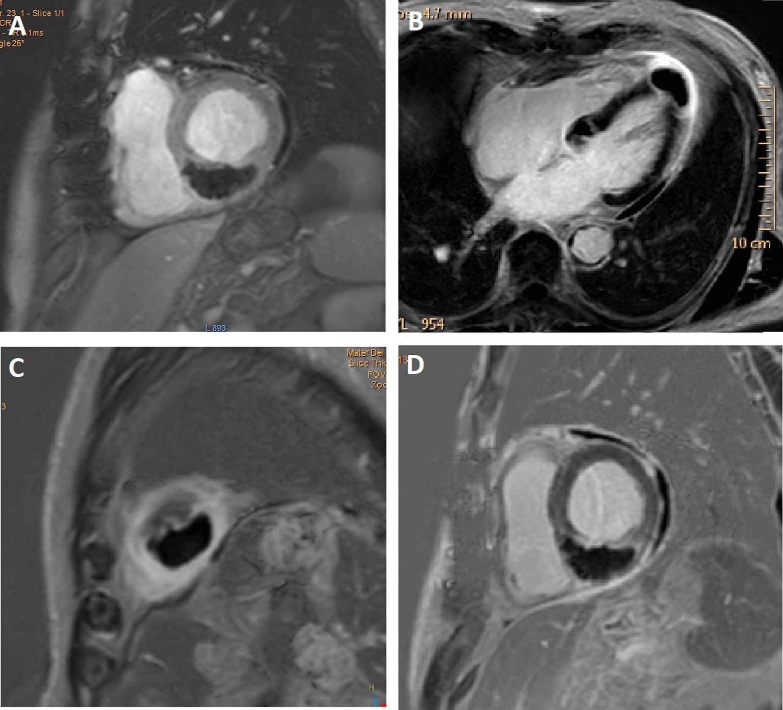 Fig. 4